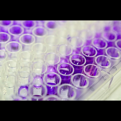 [0544-MBS703266-96T] Rat lipopolysaccharide binding protein ''LBP'' ELISA Assay   96 wells plate